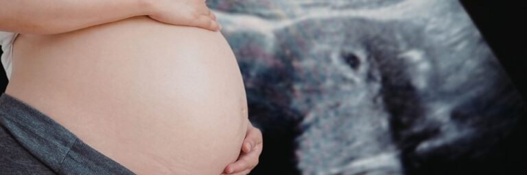 Annelikte Sağlıklı Sınırlar